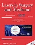 L'utilizzo del laser nella chirurgia e medicina estetica